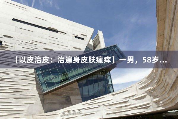 【以皮治皮：治遍身皮肤瘙痒】一男，58岁...